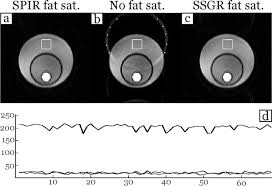 Efficient Fat Suppression By Slice Selection Gradient Reversal In Twice Refocused Diffusion Encoding Nagy 2008 Magnetic Resonance In Medicine Wiley Online Library
