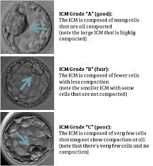 embryo grading and success rates remembryo