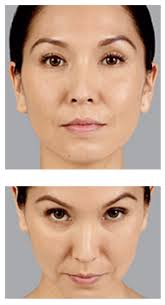 Non-Surgical Beauty Solutions Non-surgical Services
