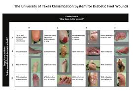 Image result for IDSA Diabetic Foot Wound Classification