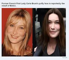 Plastic Surgeries Gone Wrong