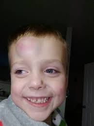 Muireann Shionagh Dunne My Baby Muireann Mandy Dunne shares the moving  story of her little baby daughter, Muireann, who was diagnosed in the womb  as having a life-limiting disability, Trisomy 13. Doctors