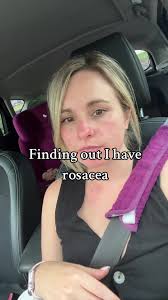 Managing Rosacea: Tips and Remedies for Redness and Sensitivity