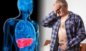 Liver cancer signs include a lump below the ribcage, pain on the right side, and more—here's everything you need to know about what's tricky is that liver cancer (and other liver diseases) usually don't have symptoms in the early stages, pillai says. Liver Cancer Symptoms Eight Signs That Could Indicate You Have The Disease Express Co Uk