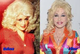 Anna is a communication expert and a life enthusiast. Dolly Parton Plastic Surgery Gracefully Getting Old Or Not Plastic Surgery Mistakes