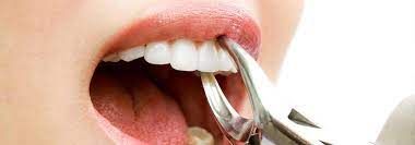 Jul 13, 2018 · what the outcome of pulling a baby tooth out too soon? Tooth Extraction Healing Time Cost Removal Process Electric Teeth