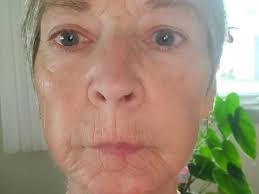 Fundraiser for Heather-Sue Duncan by Merrilyn Renkas : Help me help Heather  to eat solid foods again.