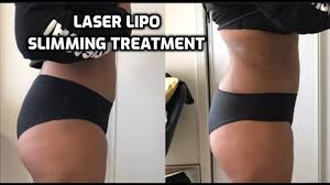 We did not find results for: I Lost 8 Inches Laser Lipo Supportasista Saturdays Youtube