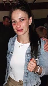 Maybe you would like to learn more about one of these? Karolina Kowalkiewicz Pokazala Mocne Zdjecia Na Facebooku Sport Wp Sportowefakty