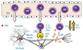 In this article, we'll go over causes, types of ms, symptoms, medications, and more. Patogenesis De La Esclerosis Multiple Bbb Blood Brain Barrier Tc T Download Scientific Diagram