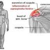 The rotator cuff is a group of four muscles and tendons that surround the glenohumeral joint. 1