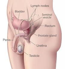 If they don't know already, your doctor will need to figure out which type of testicular cancer you have. Testicular Cancer Lab Tests Online