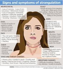 Image result for Strangulation Injury