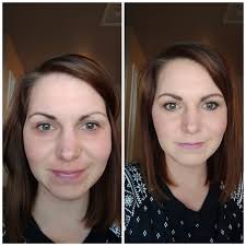 Wonky Eyes and Facial Asymmetry