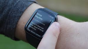 Apple Watch Ecg App What Is It How Does It Work And Is It Accurate