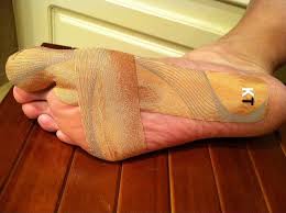 Kinesiology Tape Kt Tape Turf Toe Kt Tape Hip Problems