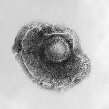 Abstract varicella zoster virus (vzv) is a ubiquitous, exclusively human alphaherpesvirus. Varizella Zoster Virus Wikipedia
