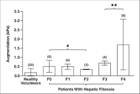 Chart Shows Mean Postprandial Liver Stiffness Augmentations