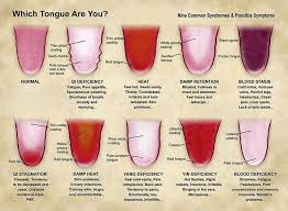 what your tongue is telling you about your health which