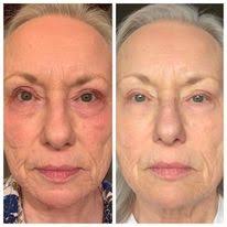 To My Polacy W Niemczech DE ( 🇵🇱 )