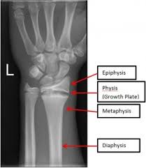 Image result for Growth Plate