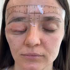Restorative Cosmetic Tattoo: Enhancing Symmetry With Nano Brows