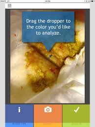 Image result for Newborn Stool Color