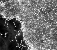 Straight Talk About Biofilms A New Answer For Treating Lyme Disease Bay Area Lyme Foundation