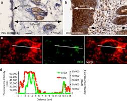 Epidermal stem cells maintain the tissue integrity during homeostasis and show remarkable plasticity to quickly respond to various stress or it is also likely that additional cellular elements of the dermis and indeed epidermis that affect epidermal renewal are yet to be identified such as neuronal cells. Epidermal Cells Help Coordinate Leukocyte Migration During Inflammation Through Fatty Acid Fuelled Matrix Metalloproteinase Production Nature Communications