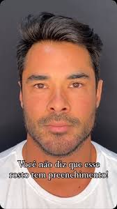 Dr Marco Antonio (@dr_marcoantonio) • Instagram फोटोहरू र भिडियोहरू