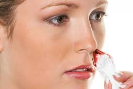 Jamais pas encore plus je ne sais pas. Arreter Un Saignement De Nez En Quelques Secondes Avec Les Huiles Essentielles Nathy D Eurveilher