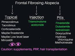 Frontal Fibrosing Alopecia What Are The Treatments Donovan Hair Clinic Alopecia Alopecia Treatment Hair Clinic