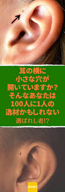 とても珍しい穴 先天性耳瘻孔 耳瘻孔 手術 耳 穴 珍しい 体 あなたの耳の周りにも 小さな穴があいていませんか それは 欧米だと100人に1人の割合で発生するといわれる先天性耳瘻孔 じろうこう words