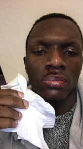 The Buzz Sits With Rayshawn Watkins, Victim of Alleged Hate Crime