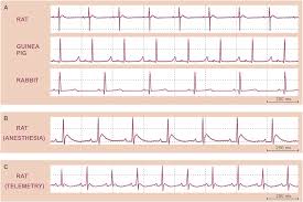 Image result for Electrocardiogram Validity