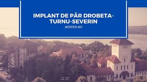 From wikimedia commons, the free media repository. Implant De Par Drobeta Turnu Severin Minind