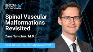 Spinal Vascular Malformations Revisited