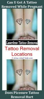 Tattoo Removal Service Can I Tattoo Over A Mole I Removed Can Tattoo Removal Make You Sick How Much Does Laser Ta Tattoo Removal Cost Tattoo Removal Skin Moles
