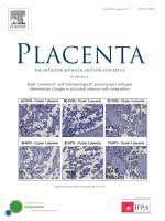 La dominicana gloria stephanie gómez tiene varias facetas a destacar, entre ellas su empresa de moda y su entusiasmo por la fotografía, pero sin duda. Placenta Vol 83 Pages E1 E146 1 72 August 2019 Sciencedirect Com By Elsevier