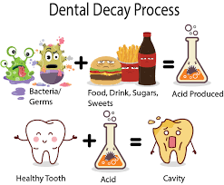 How To Prevent Dental Decay | Smile Humboldt