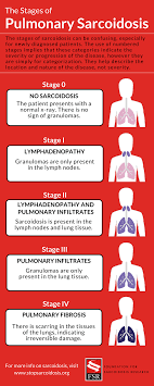What are the 4 stages of emphysema. The Stages Of Pulmonary Sarcoidosis What Do They Really Mean Foundation For Sarcoidosis Research
