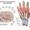 Tendon contractures of the hand. 1