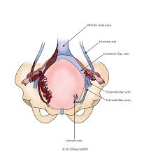 Image result for Postpartum Fever