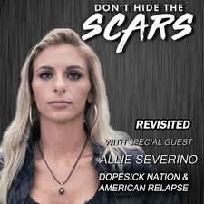 Fentanyl Is Killing Everybody, Experimentation Is No Longer A Right Of  Passage with Richard Taite by Don't Hide The Scars. Presented By PAIN:  Parents & Addicts In Need