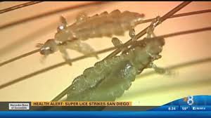 Health Alert Super Lice Strikes San Diego Cbs8 Com