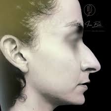 Muy feliz de terminar otro escalón. Inmensamente agradecida por haber  tenido esta oportunidad. seguiré preparándome para que en mis manos esté  aportar siempre lo mejor a esta hermosa especialidad.