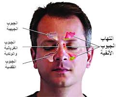 الجيوب الأنفية يشعلها البرد ويطفئها البخار المدينة