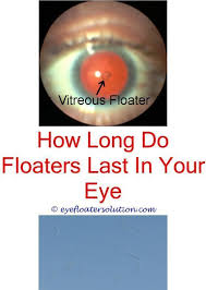 Eye Floaters Naturopath Seeing Black Floaters In Right Eye Eye Floaters Improve Home Remedies Main Causes Eye Floaters Treatment Floaters Eye Chronic Dry Eye