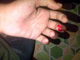 15 6 pisau bergerigi dapur. Anje On Twitter Best Kan Tangan Aku Kena Pisau Http T Co Nbe6orxk