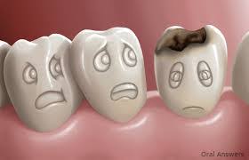 Make sure to schedule regular visits to. Is It Possible To Reverse Tooth Decay Hilton Dental Practice